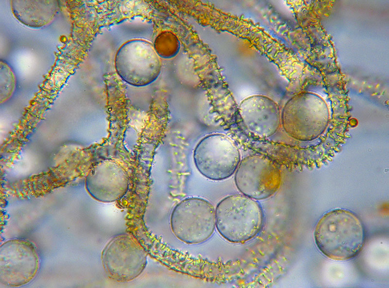 Arcyria (pomiformis ?)